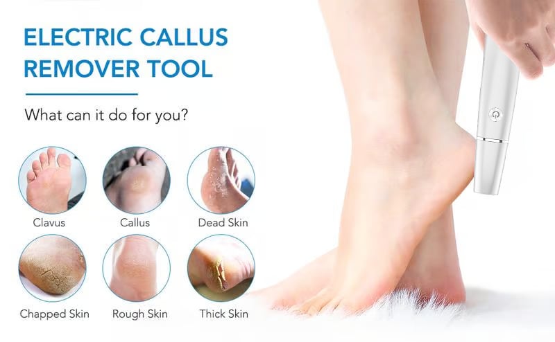 🌸Electric Feet Callus Remover