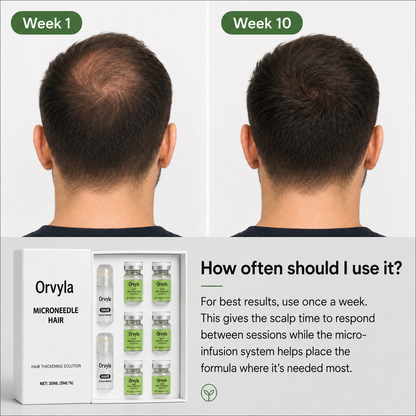 Hair Growth Support System – Scalp Care Kit for Thicker, Fuller-Looking Hair