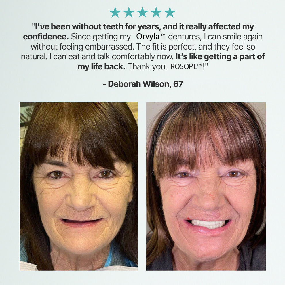DENTURES-Boil-and-Bite Functional Denture, Self-fit at Home, Fully Adjustable for Narrow or Wide Arches, Long or Short-term Solution, Eat, Drink and Smile Confidently