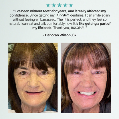 DENTURES-Boil-and-Bite Functional Denture, Self-fit at Home, Fully Adjustable for Narrow or Wide Arches, Long or Short-term Solution, Eat, Drink and Smile Confidently