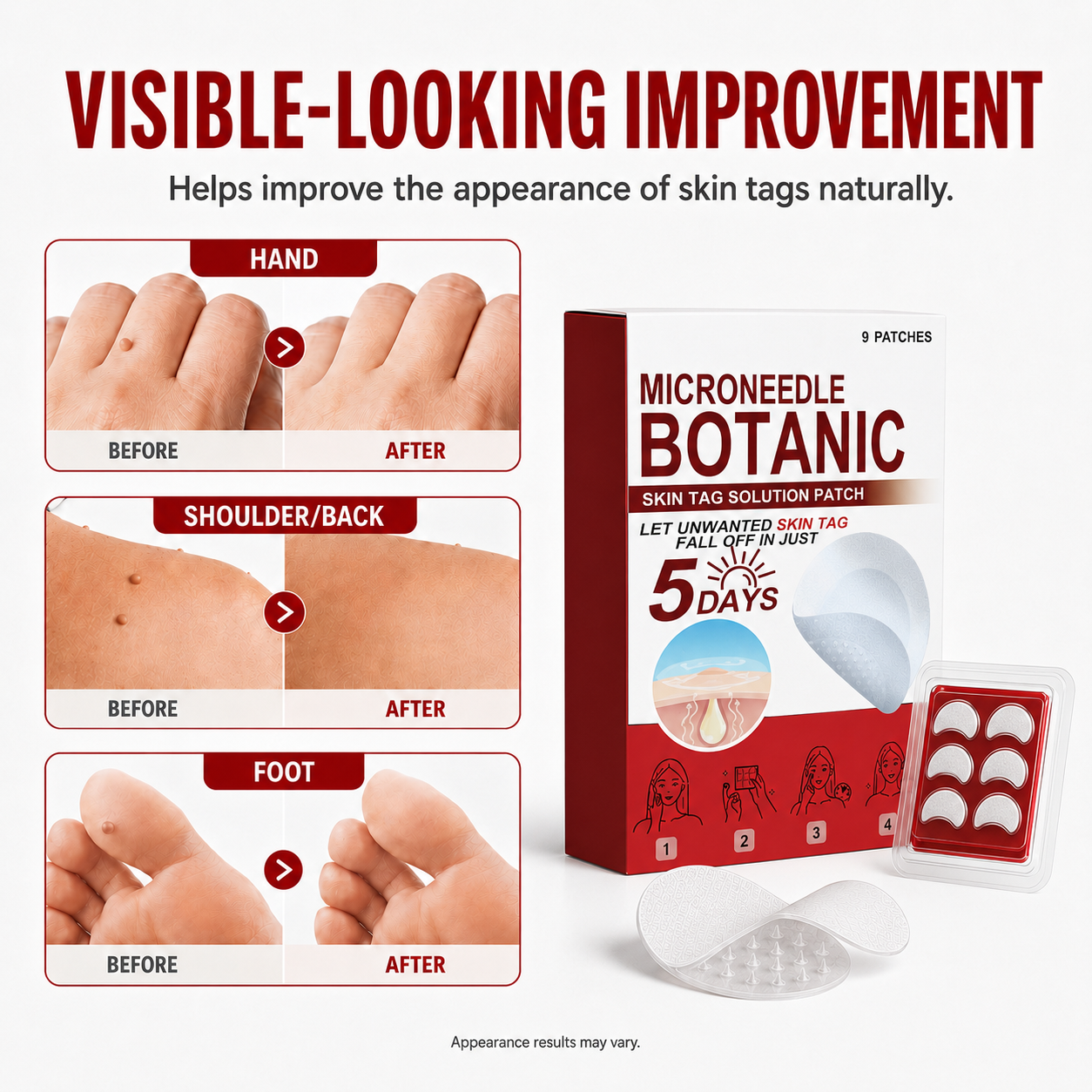 🗽✅Botanical Microdart Skin Tag Care Patches – Targeted Spot Patches for At-Home Skin Care
