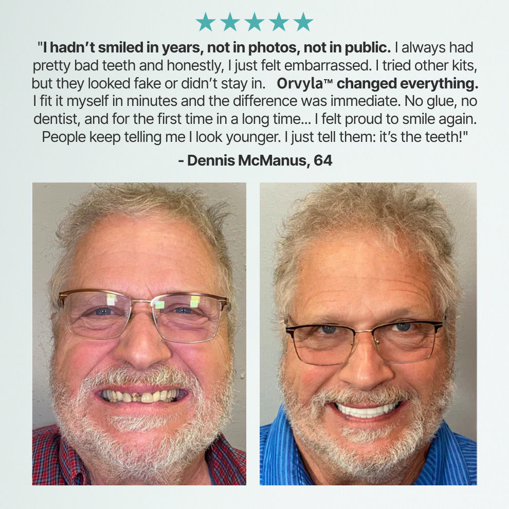 DENTURES-Boil-and-Bite Functional Denture, Self-fit at Home, Fully Adjustable for Narrow or Wide Arches, Long or Short-term Solution, Eat, Drink and Smile Confidently