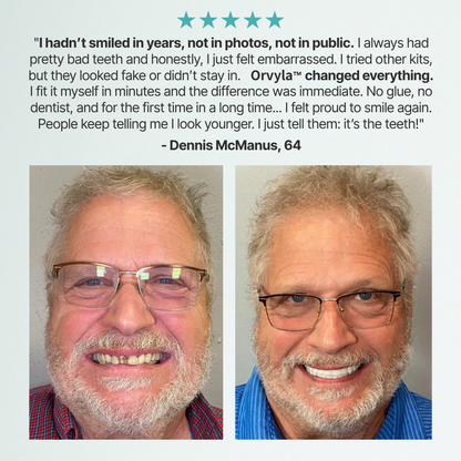 DENTURES-Boil-and-Bite Functional Denture, Self-fit at Home, Fully Adjustable for Narrow or Wide Arches, Long or Short-term Solution, Eat, Drink and Smile Confidently